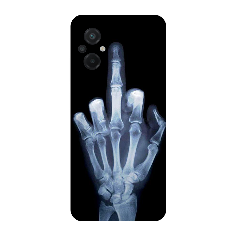 Чехол для Poco M5 2022 4G Футб – обзор и цена Phone Cases Liverpool
